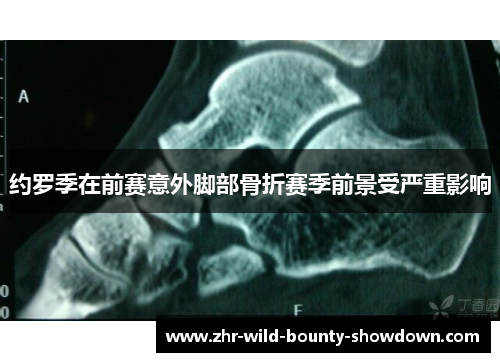 约罗季在前赛意外脚部骨折赛季前景受严重影响 约罗季在前赛意外脚部骨折赛季前景受严重影响
